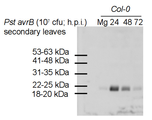 western blot using anti-PR-4 antibodies